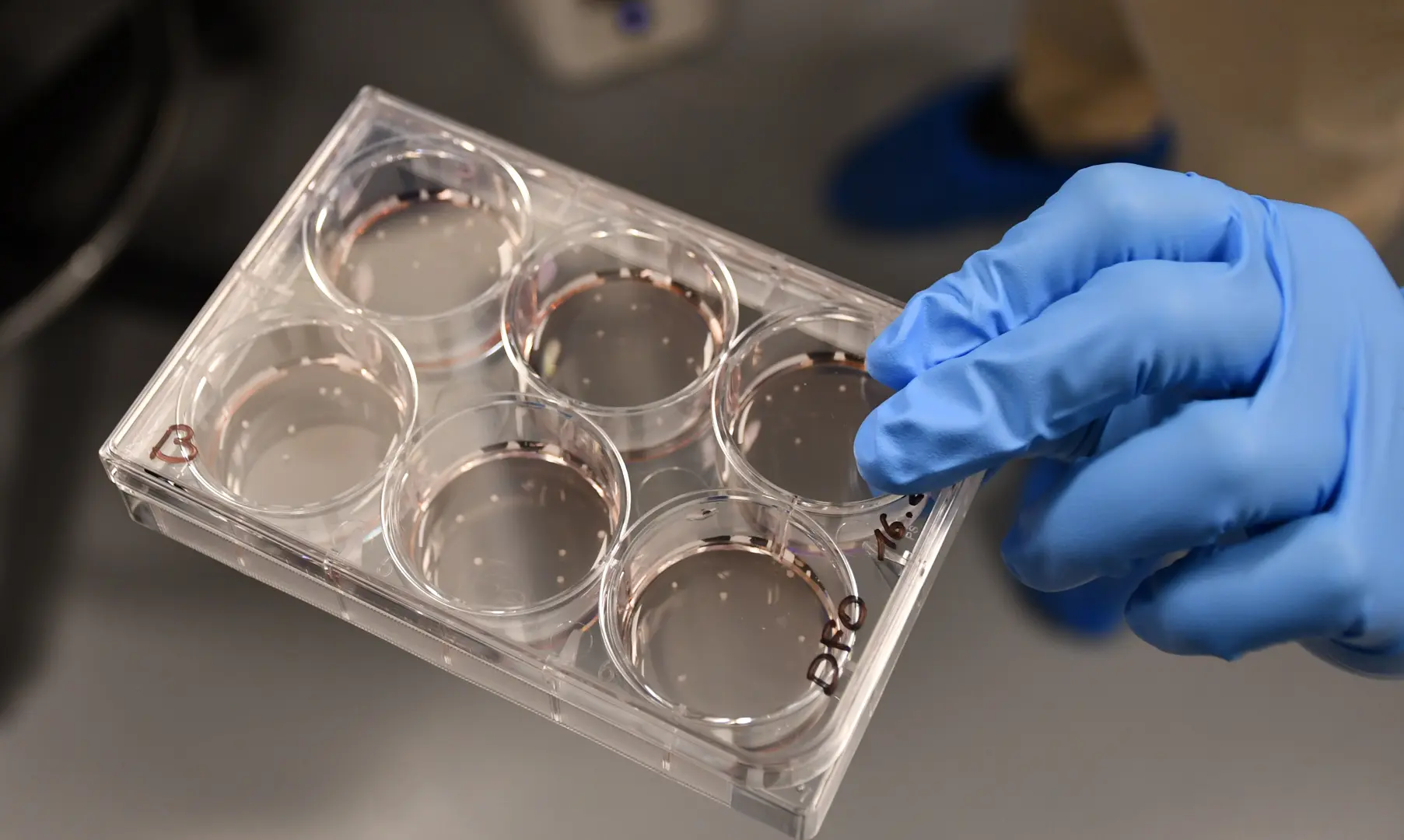 Lab-grown brain organoids in petri dish for neuroscience research