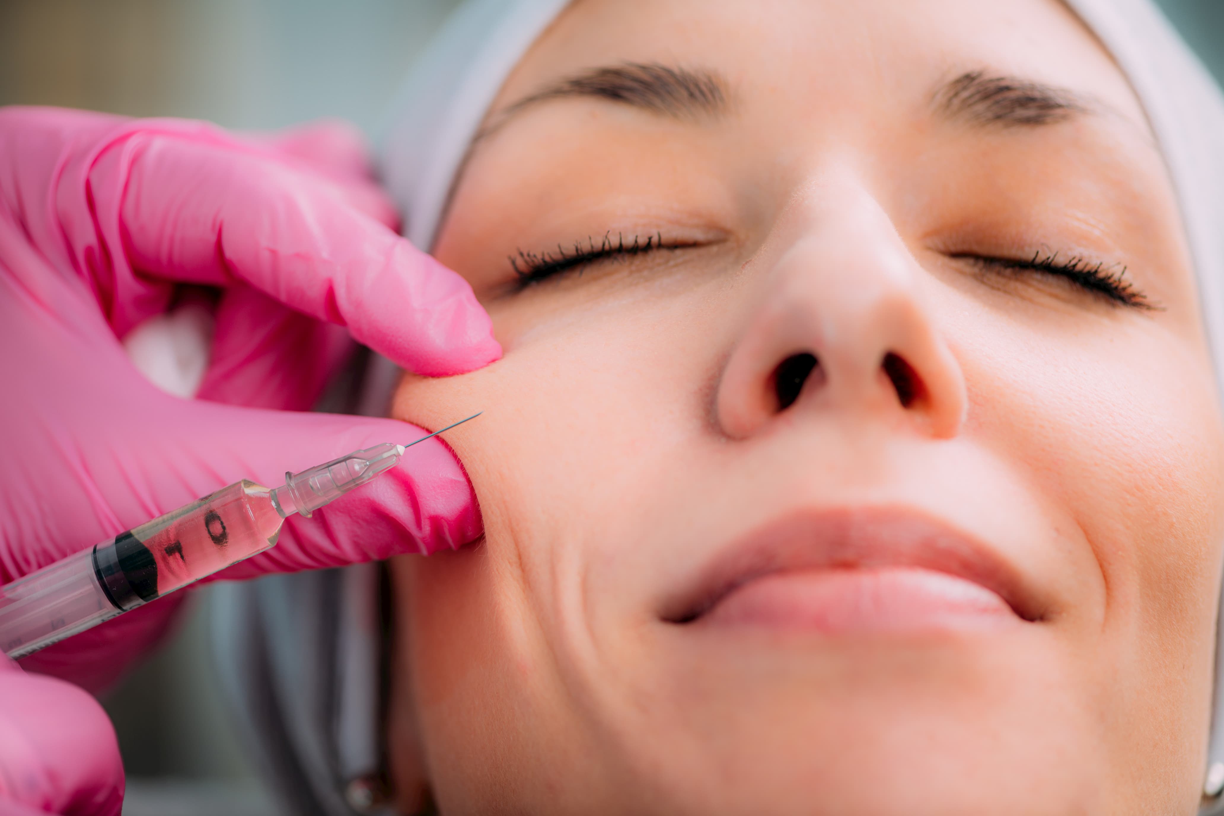 juvederm treatment