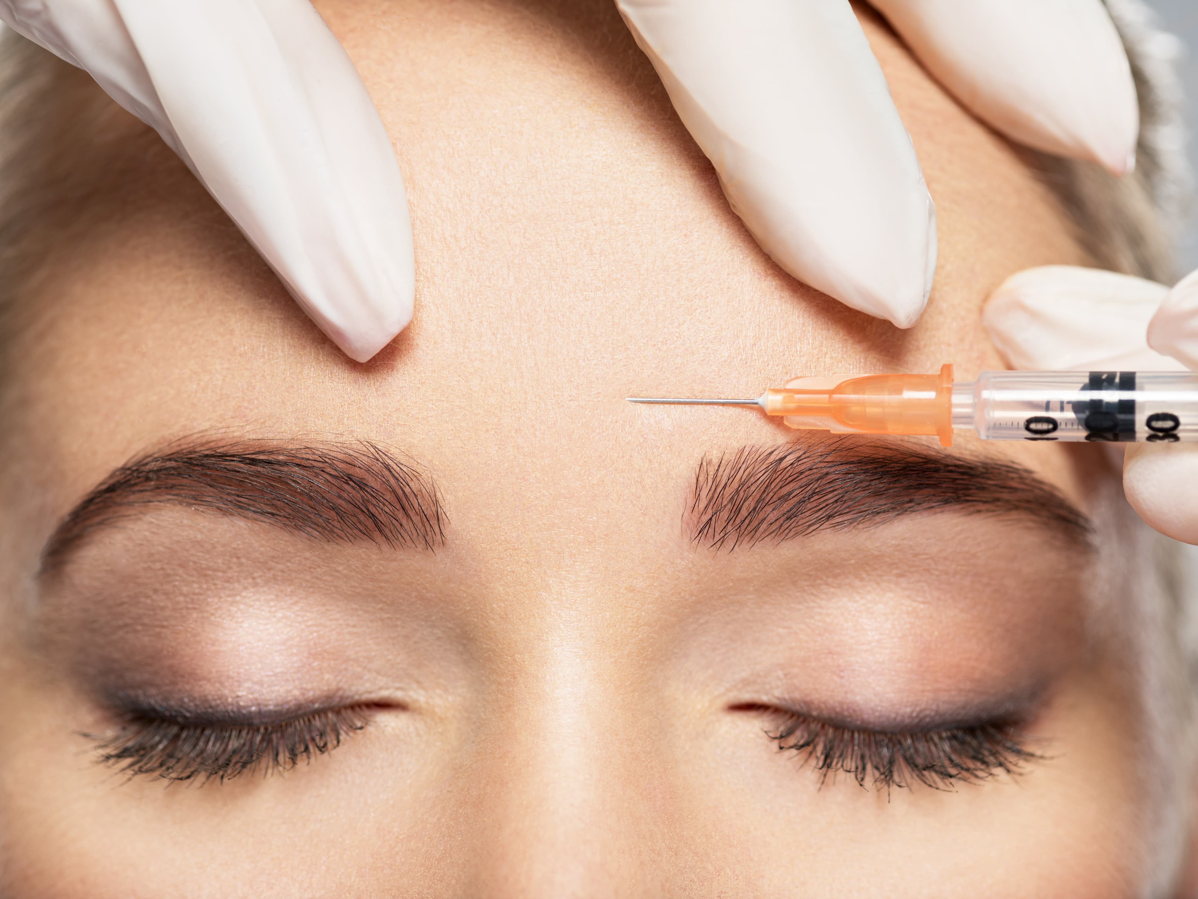 botulinum toxin injections