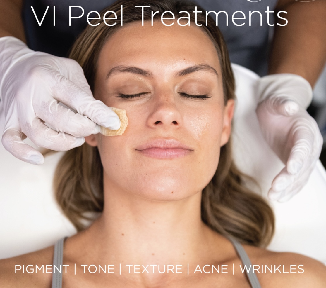 vi peel treatment