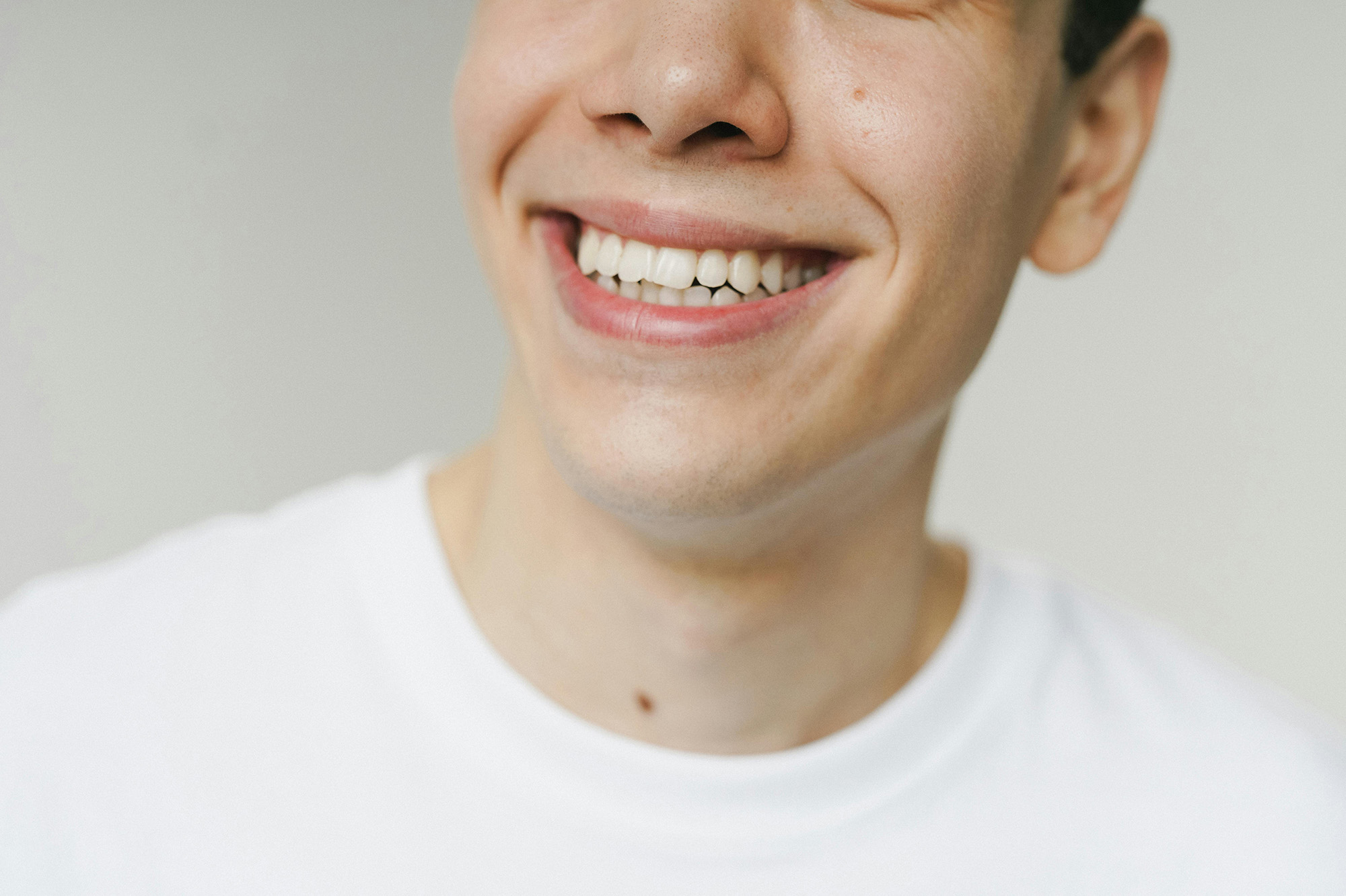Close-up of a smiling person showing white teeth and wearing a white shirt.