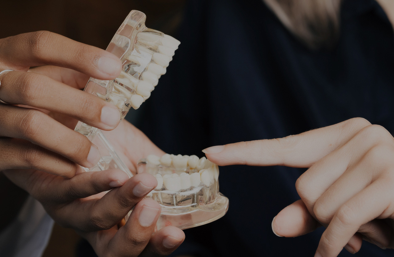 Hands holding and pointing at a dental model showing teeth.