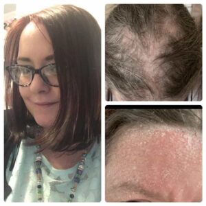 Laura_Mills_scalp