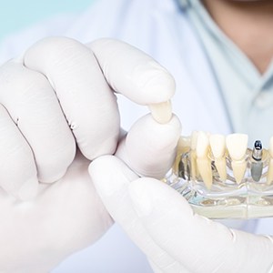 Dentist holding parts of dental implant