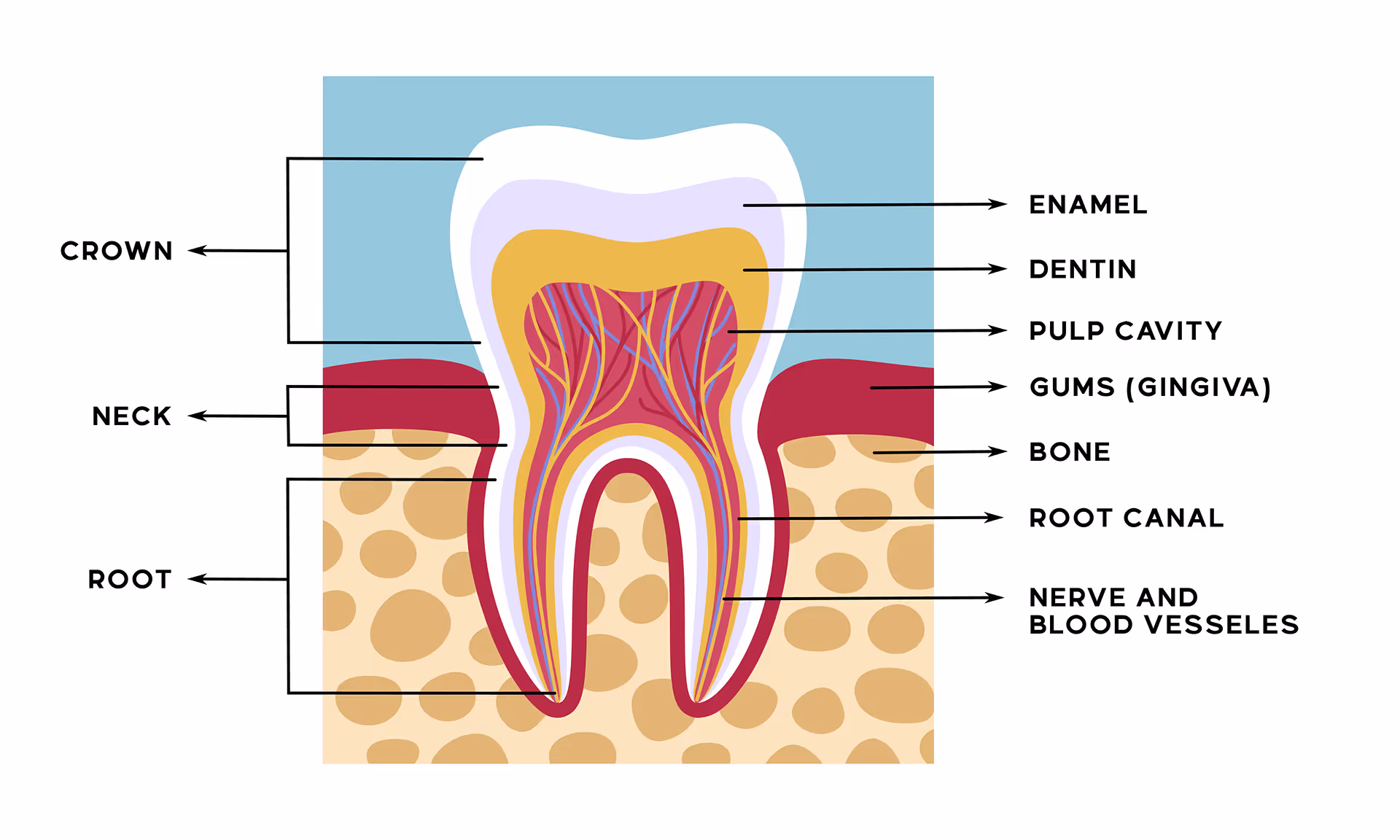 Diagram showing tooth enamel protection and exposed root causing sensitivity