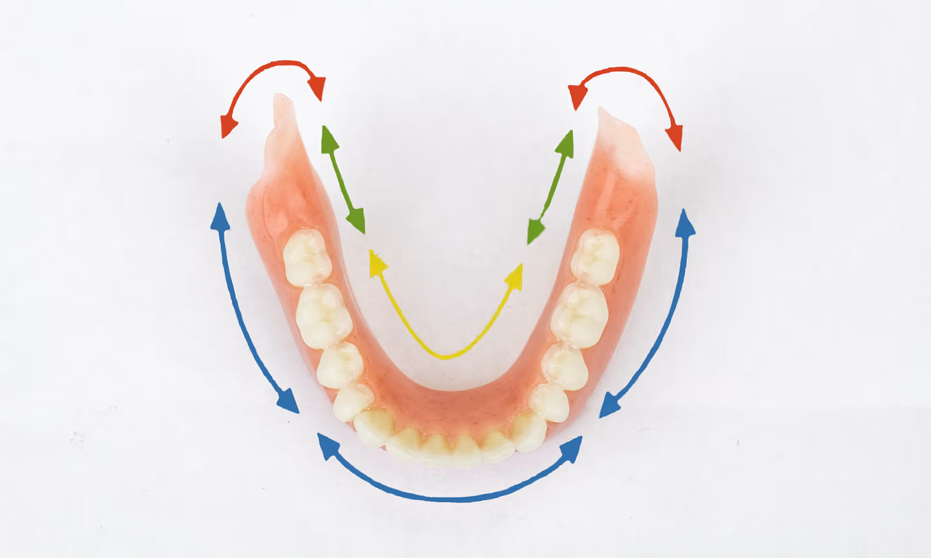 Diagram showing lower denture shifting during chewing