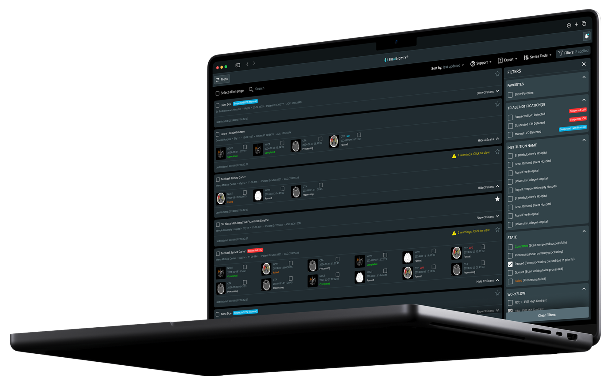 Brainomix 360 Stroke laptop interface