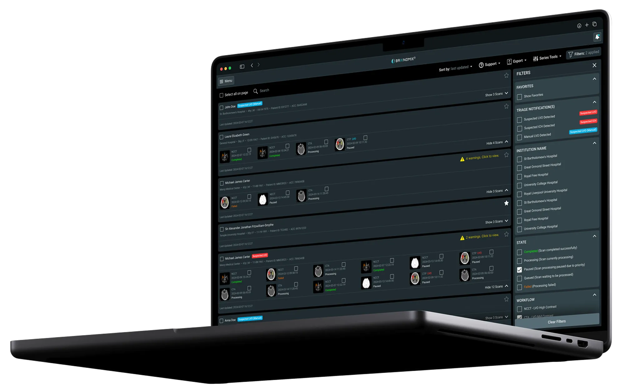 Brainomix 360 Stroke laptop interface