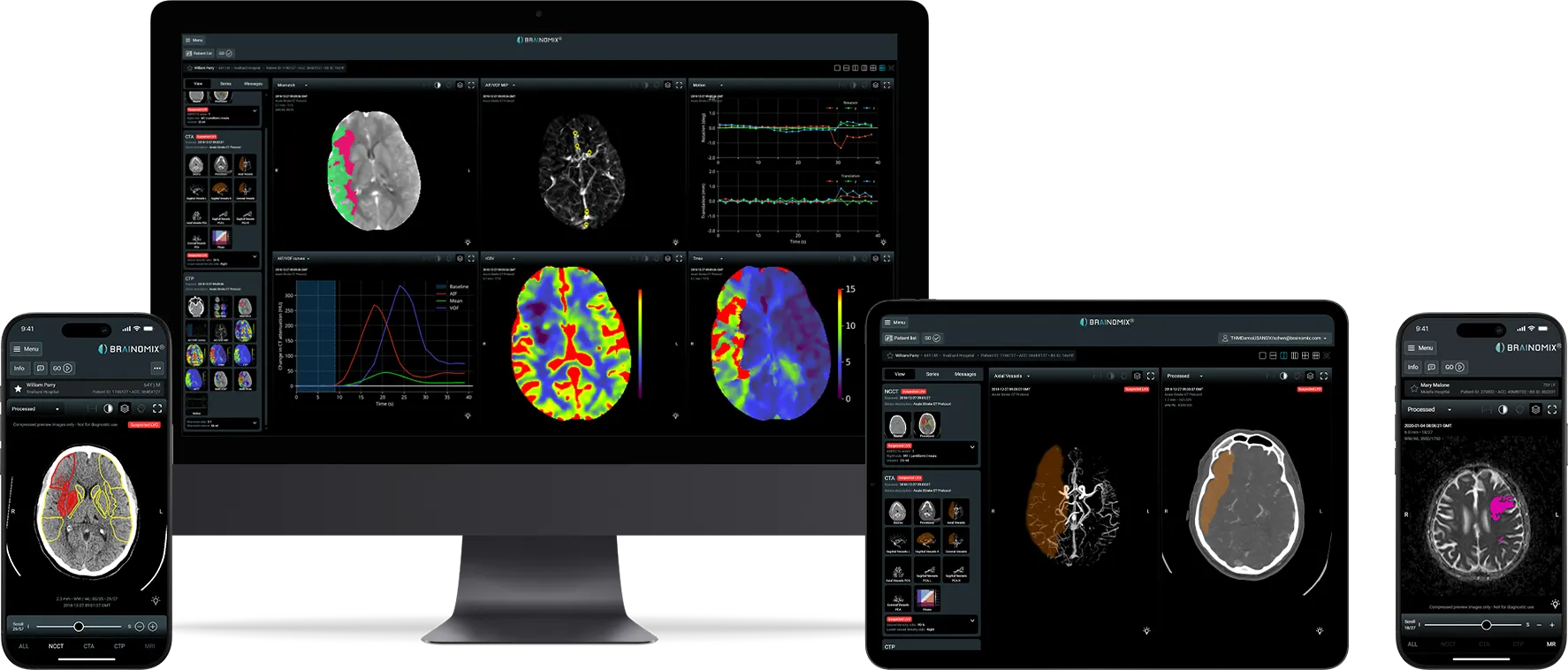 Medical brain scan images with colored regions shown on computer, tablet, and mobile screens in Brainomix software.