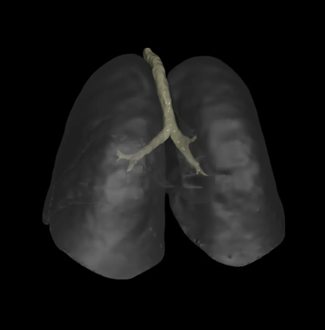 3D rendering of human lungs and trachea against a black background.