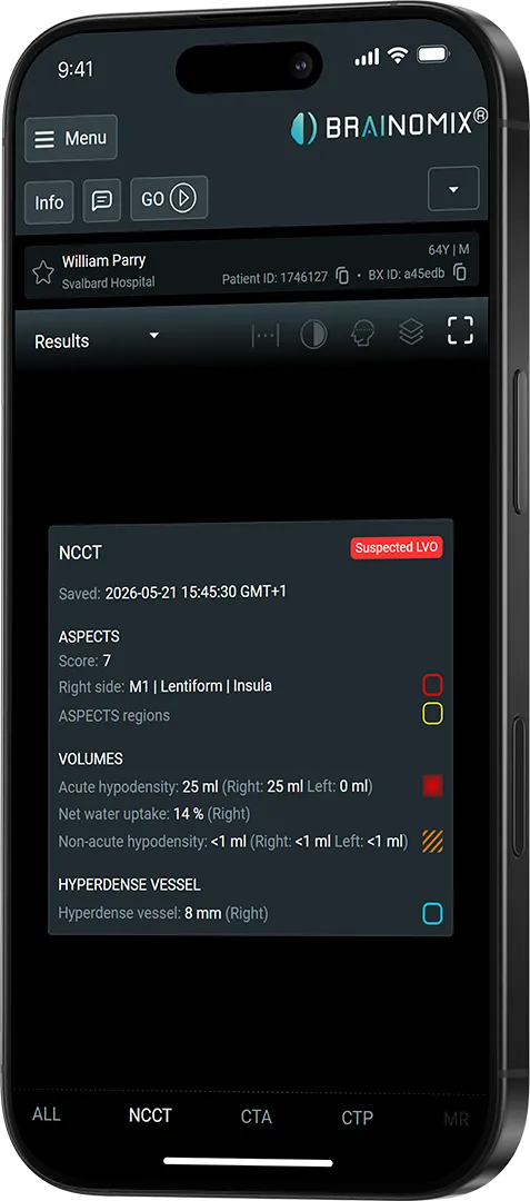 Brainomix app showing NCCT results for patient William Parry with suspect LVO and ASPECTS score 7 data.