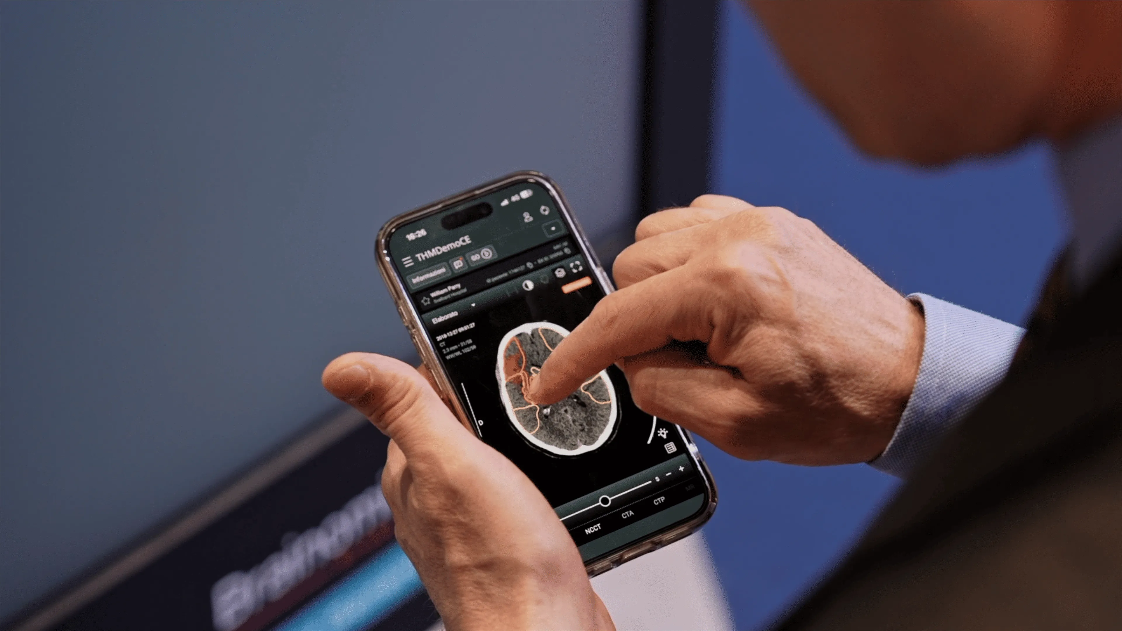 Person using a smartphone to view a brain scan image with highlighted areas on the screen.