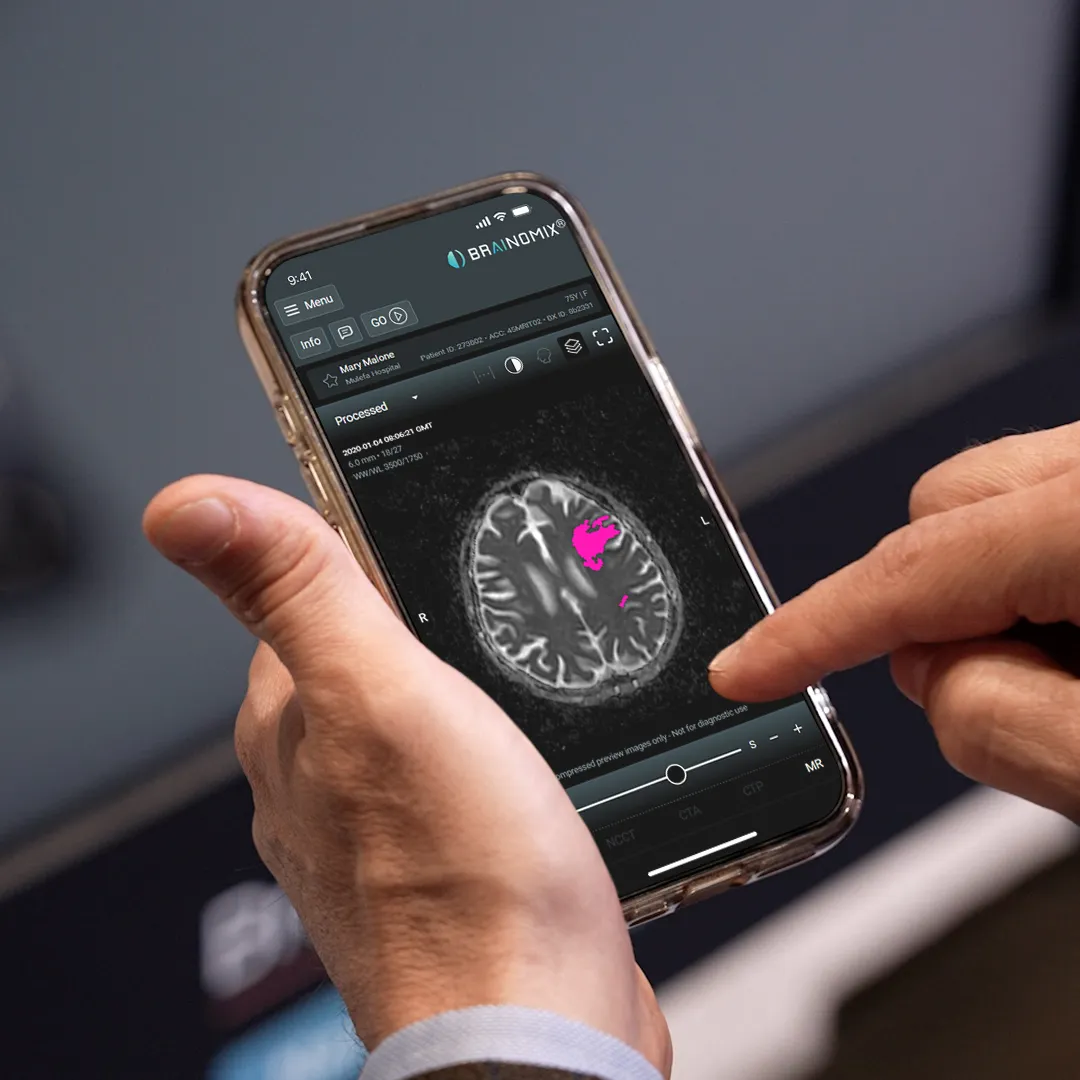 MRI Analysis brain scan