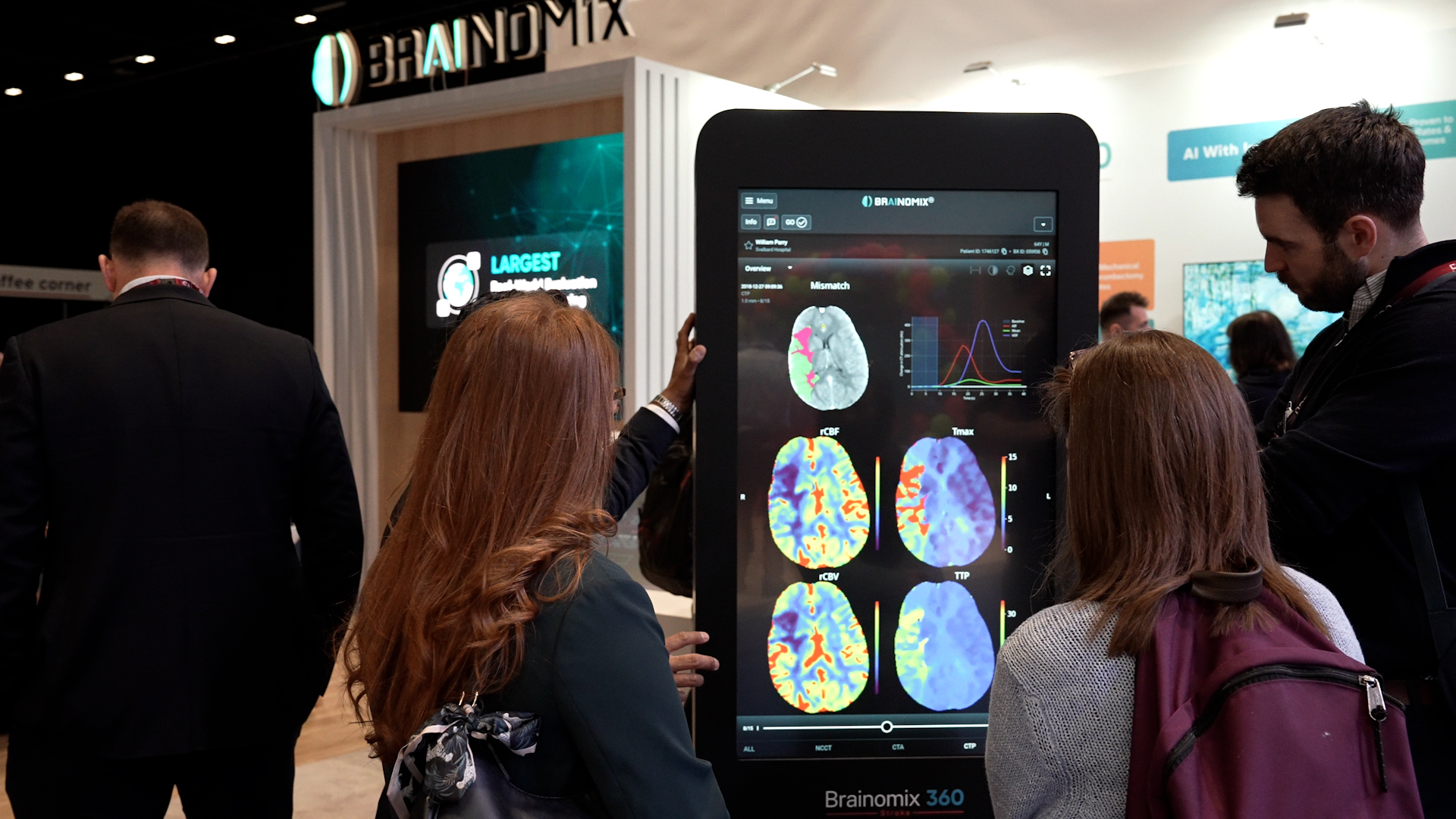 People interacting with a large screen showing brain scan images at a Brainomix booth.