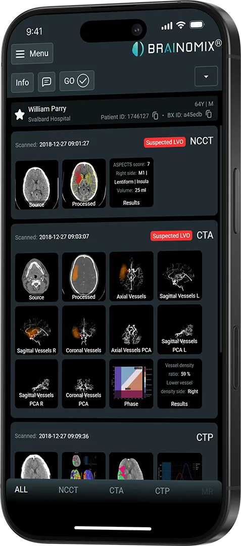 Mobile app screen showing brain scan images and analysis results for patient William Parry.