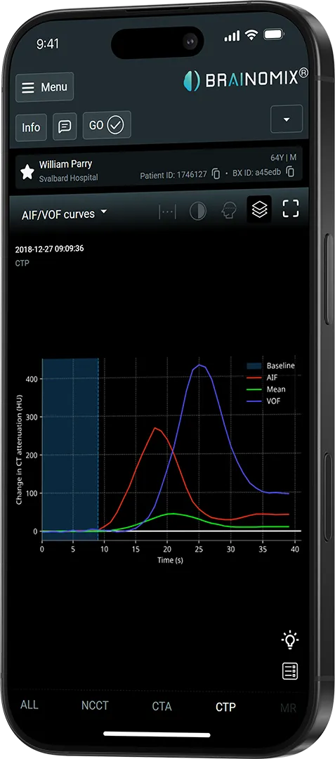 Smartphone showing Brainomix software with AIF/VOF curves graph of CT attenuation change over time.