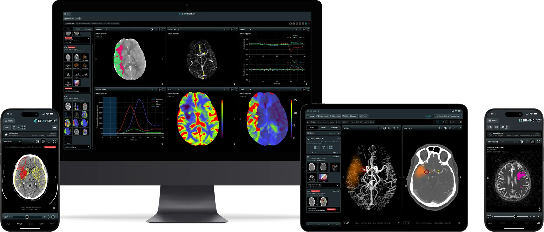Brain imaging software shown on a desktop, tablet, and phones with colored MRI and CT brain scans.