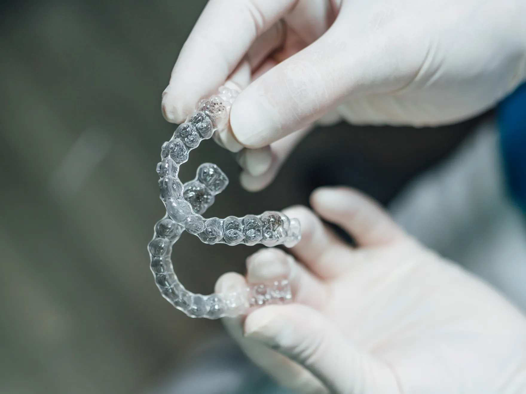 Gloved hands holding clear dental aligners used for orthodontic treatment.
