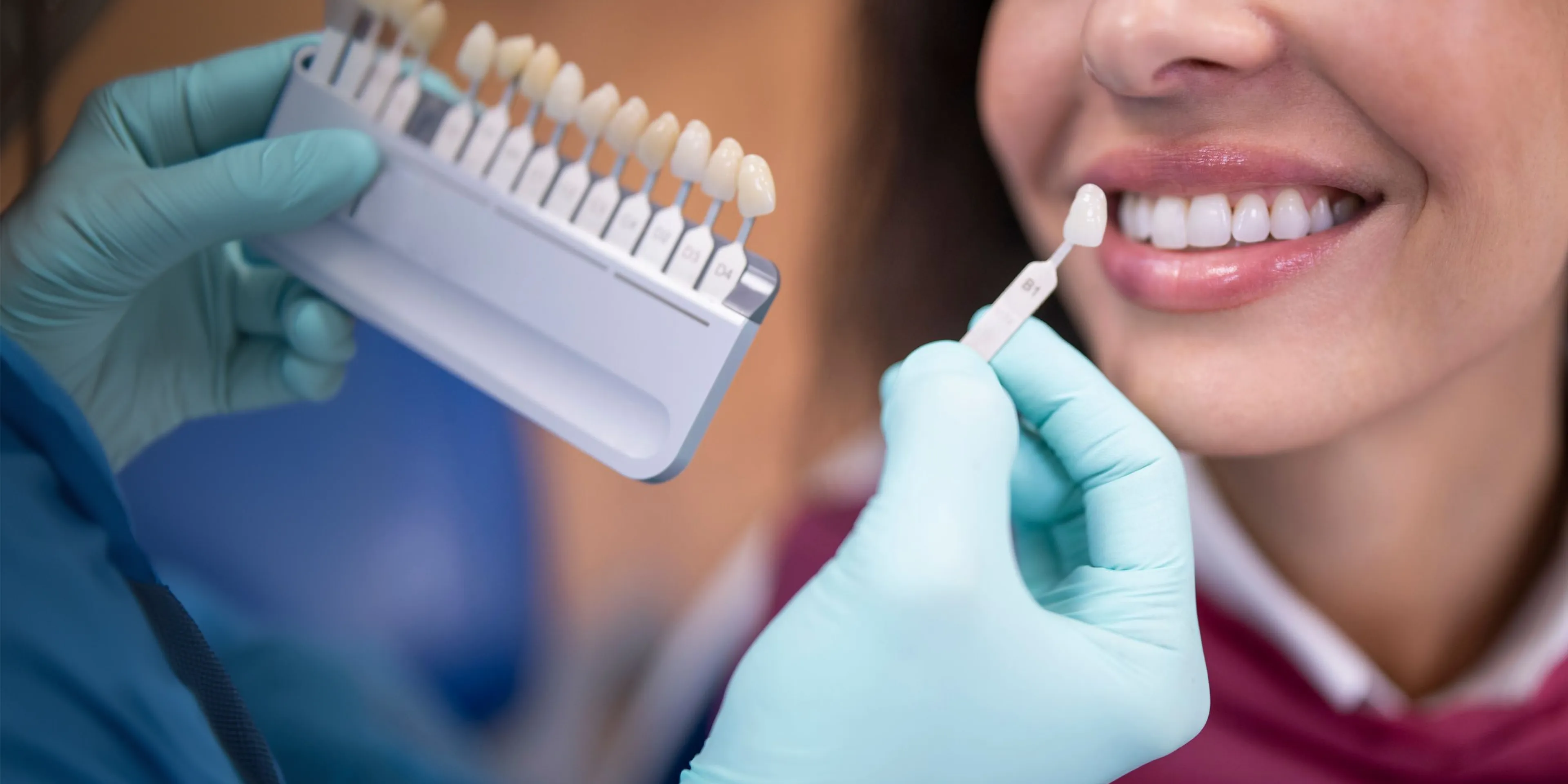 Dentist with blue gloves matching dental veneers shades to a smiling woman's teeth.