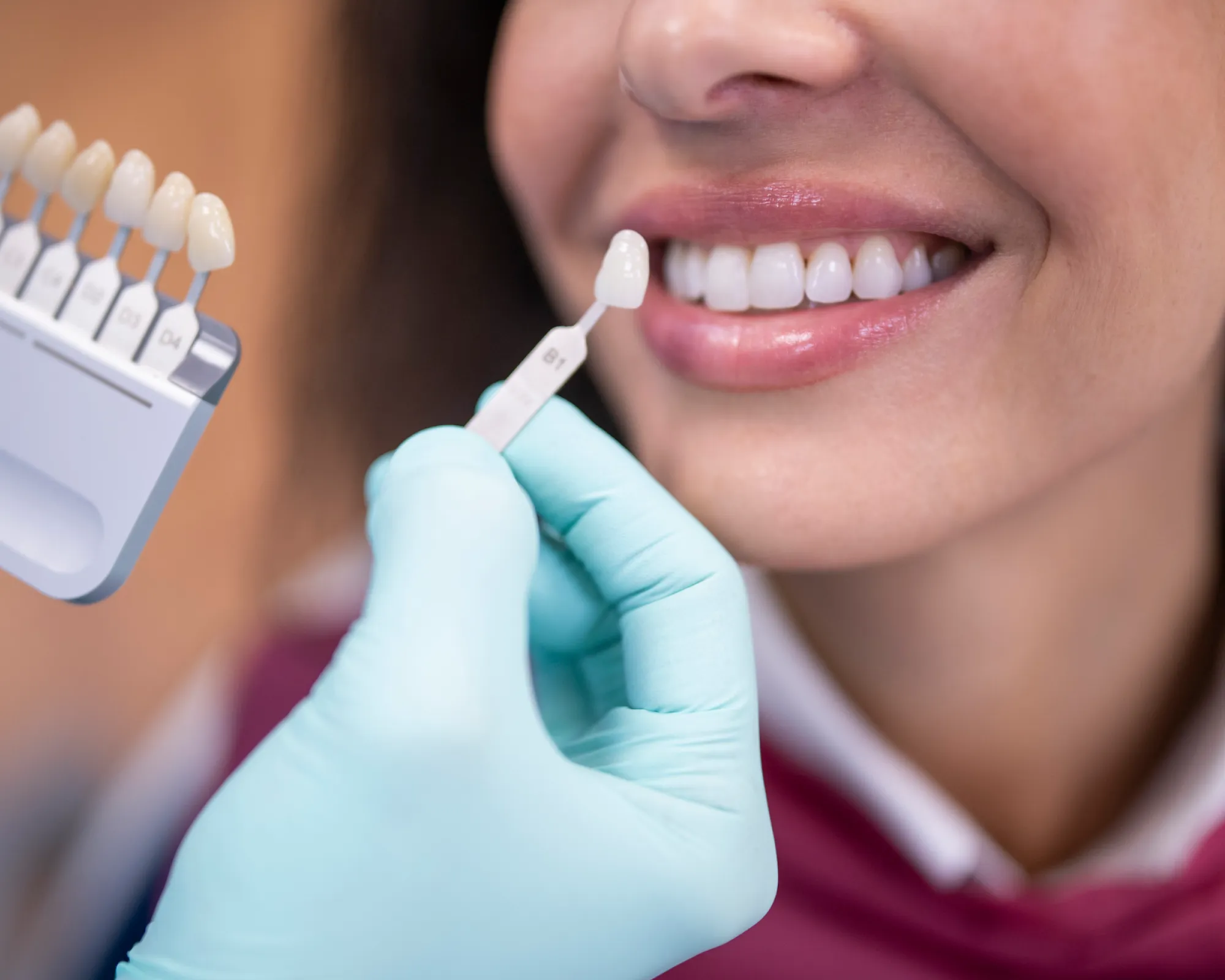 Dentist comparing a tooth shade guide with a patient's teeth for color matching.