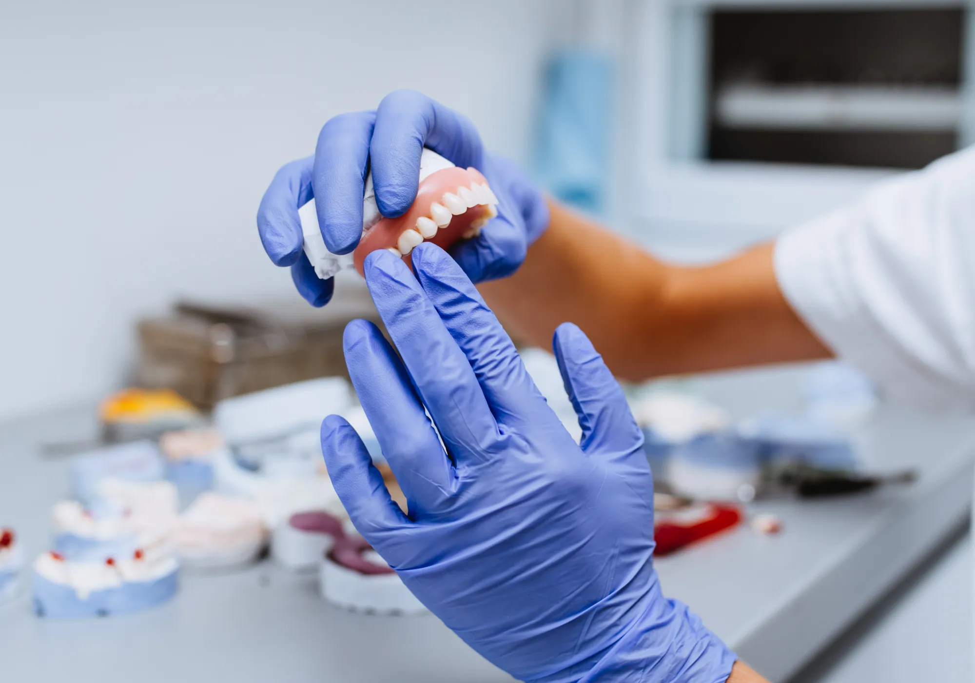 Person wearing blue gloves holding a dental mold with artificial teeth.
