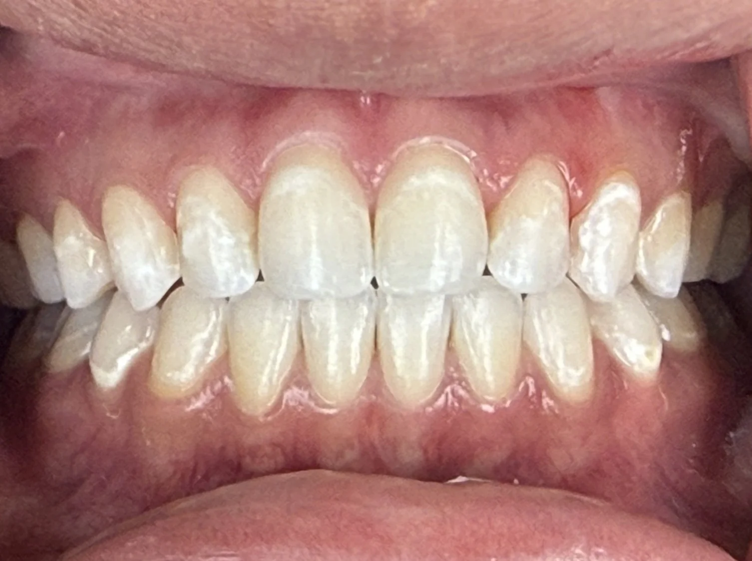 Before Image