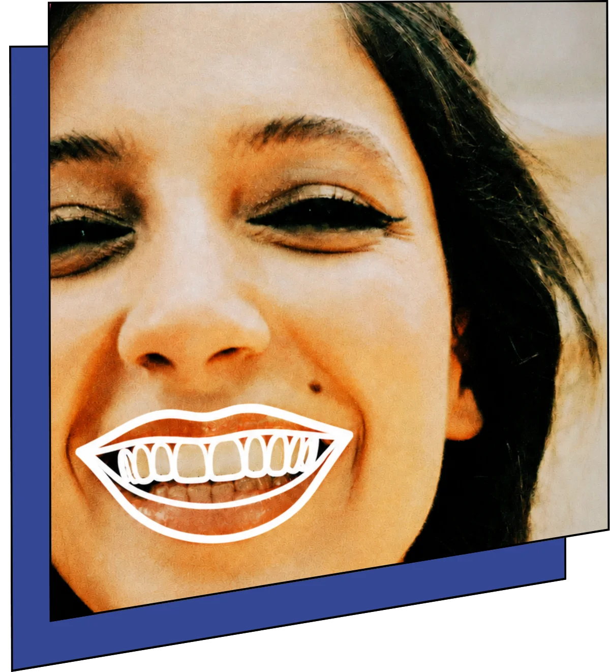 Dental Crowns