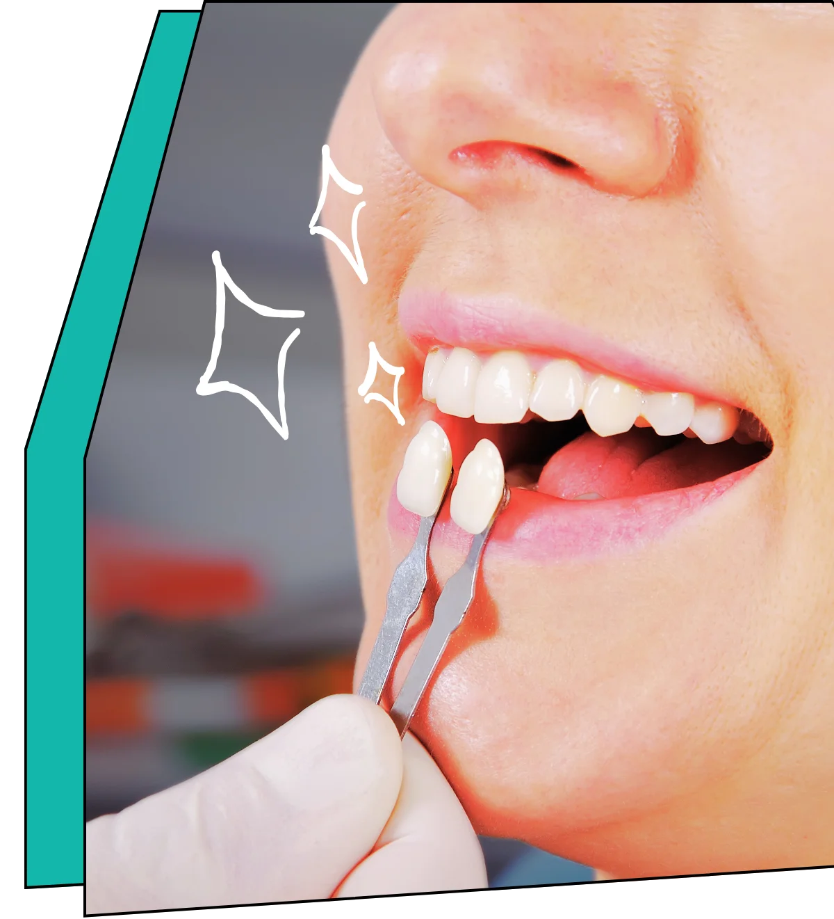Cosmetic Dental
