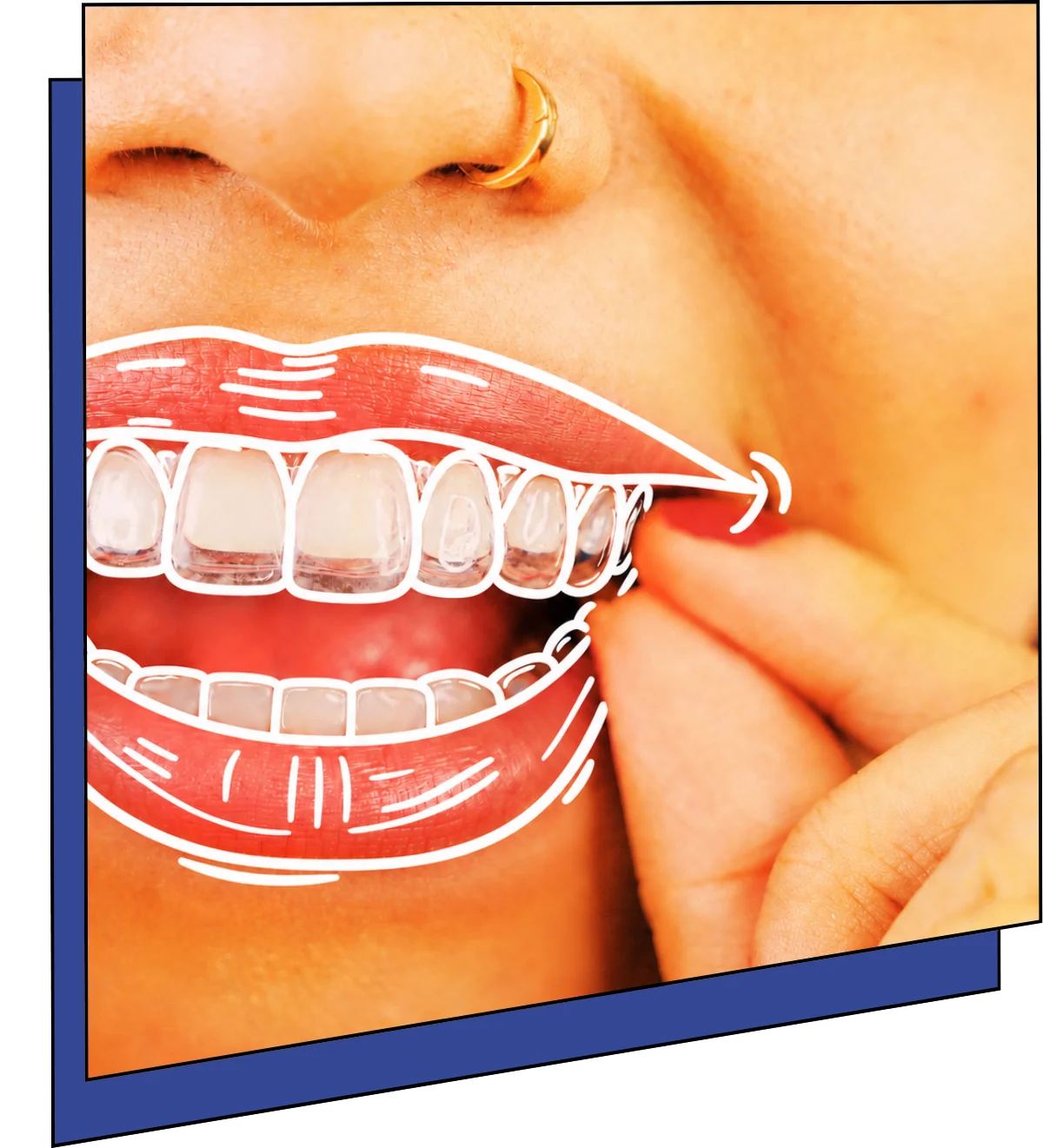 Cosmetic Dental