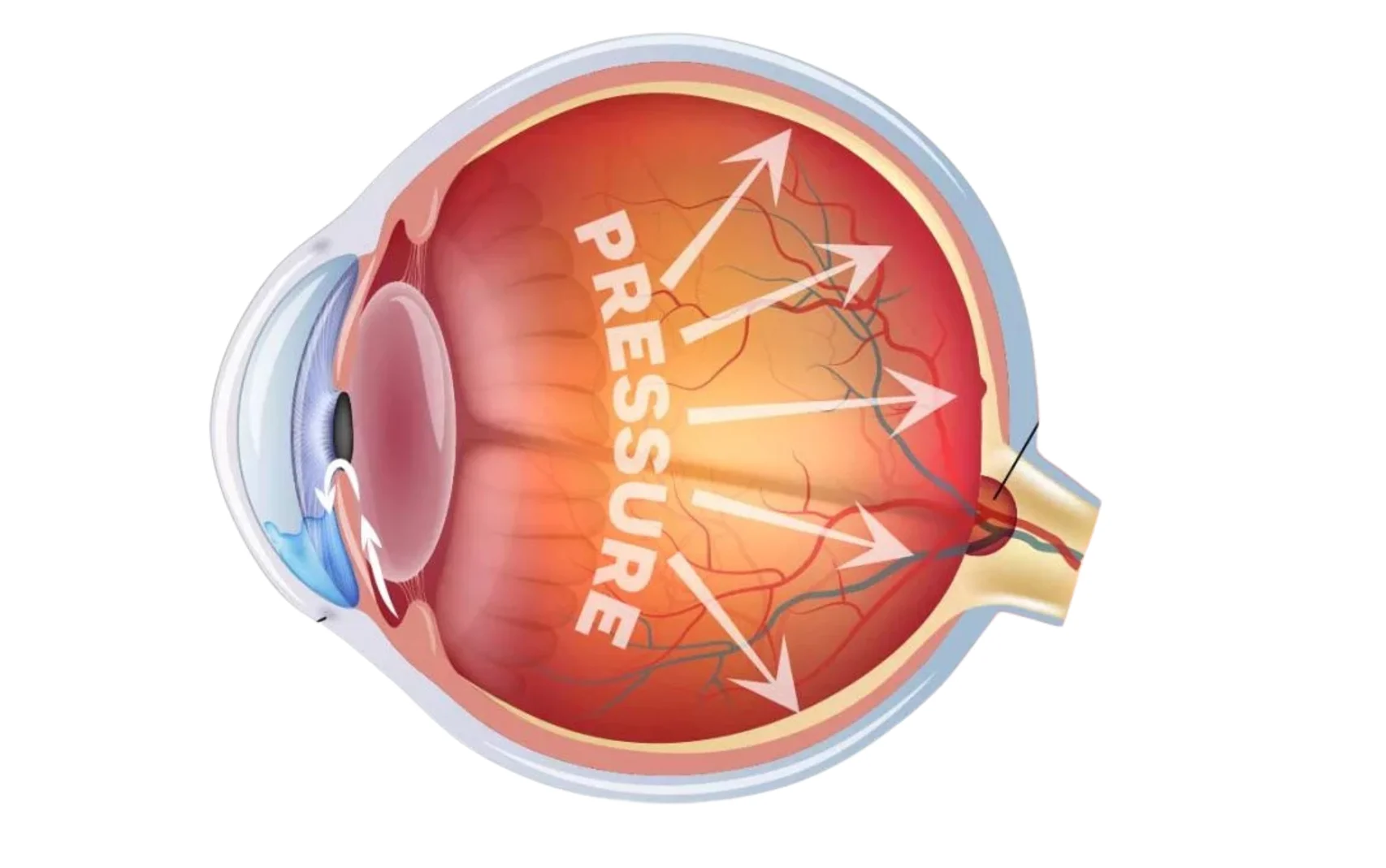Glaucoma Treatment: Protecting Your Vision