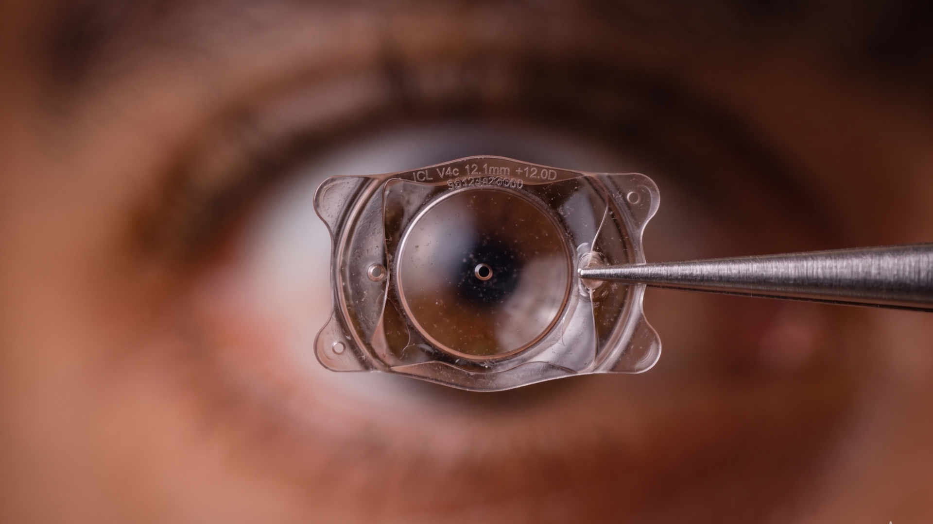  ICL Surgery: High-Definition Vision Correction