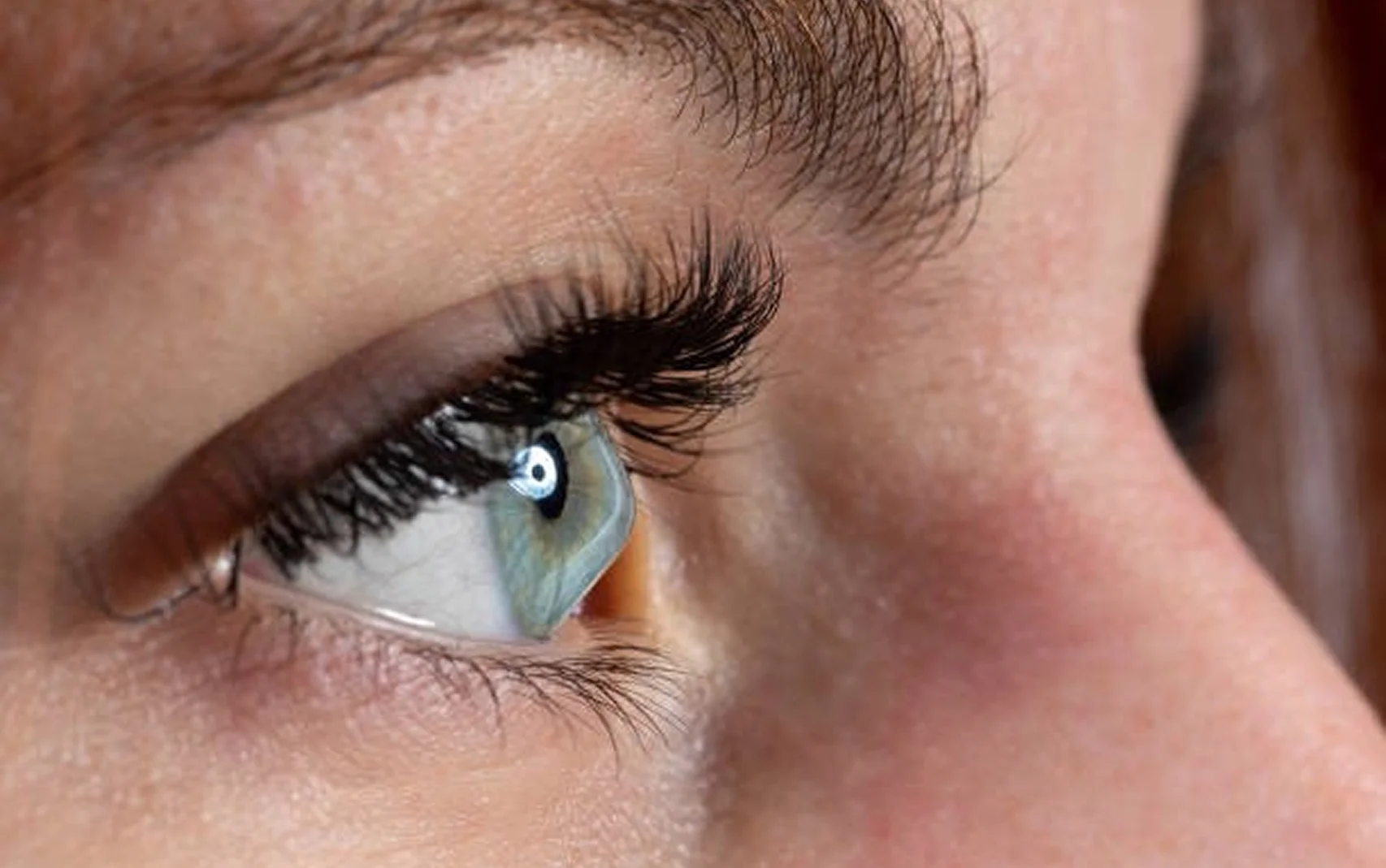 Keratoconus & Corneal Cross-Linking Treatment 