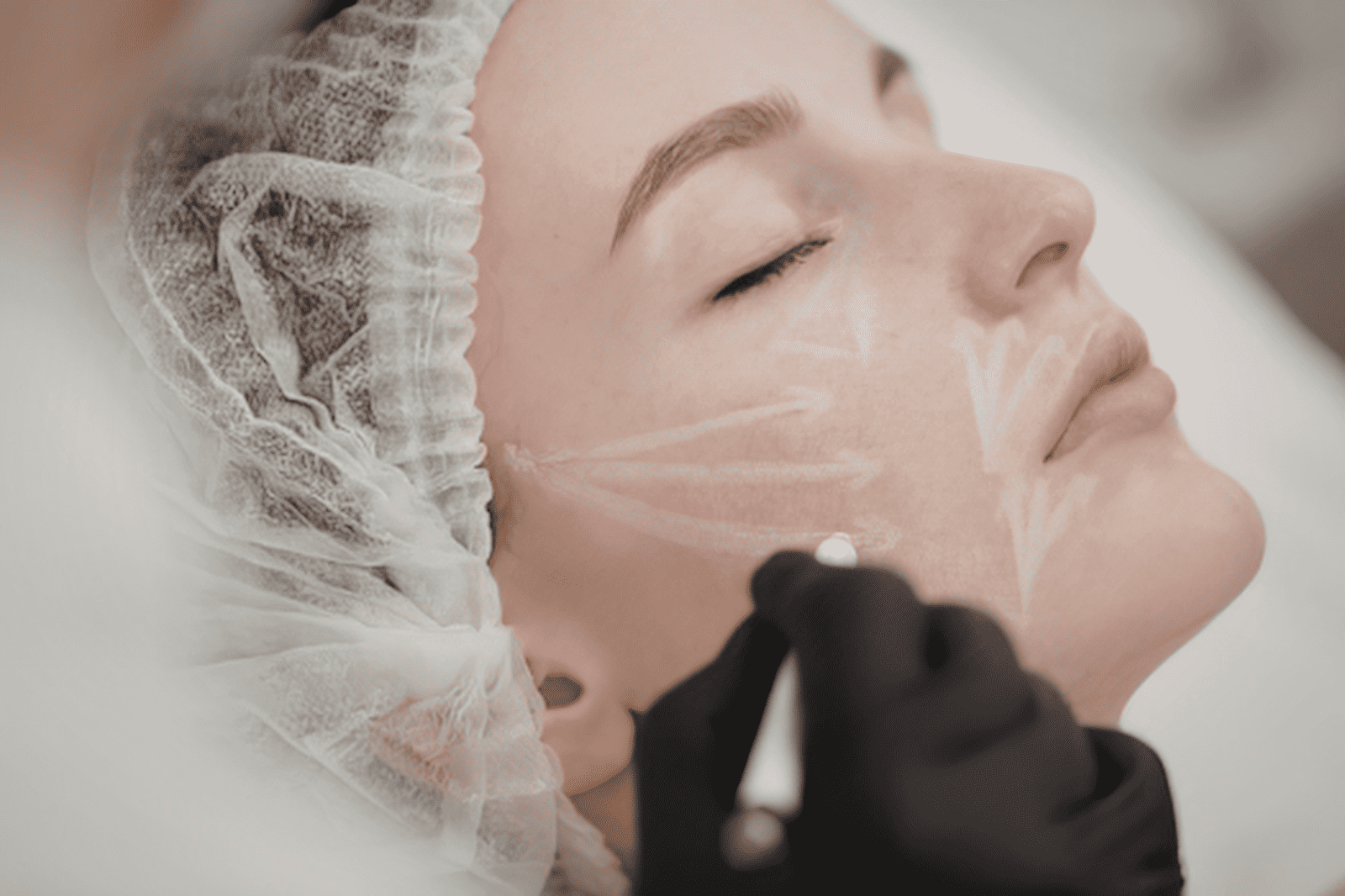 Biostimulatoren im Vergleich: Sculptra, PCL-Fäden & Polynukleotide