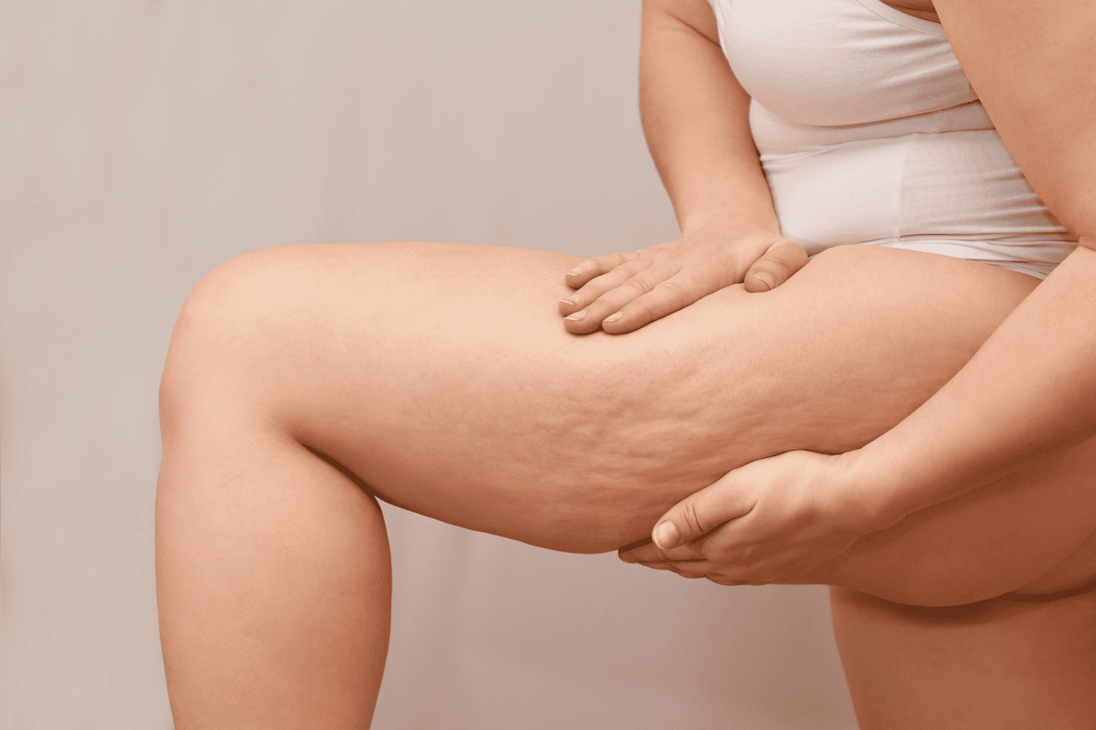 Sculptra gegen Cellulite: was geht, was nicht