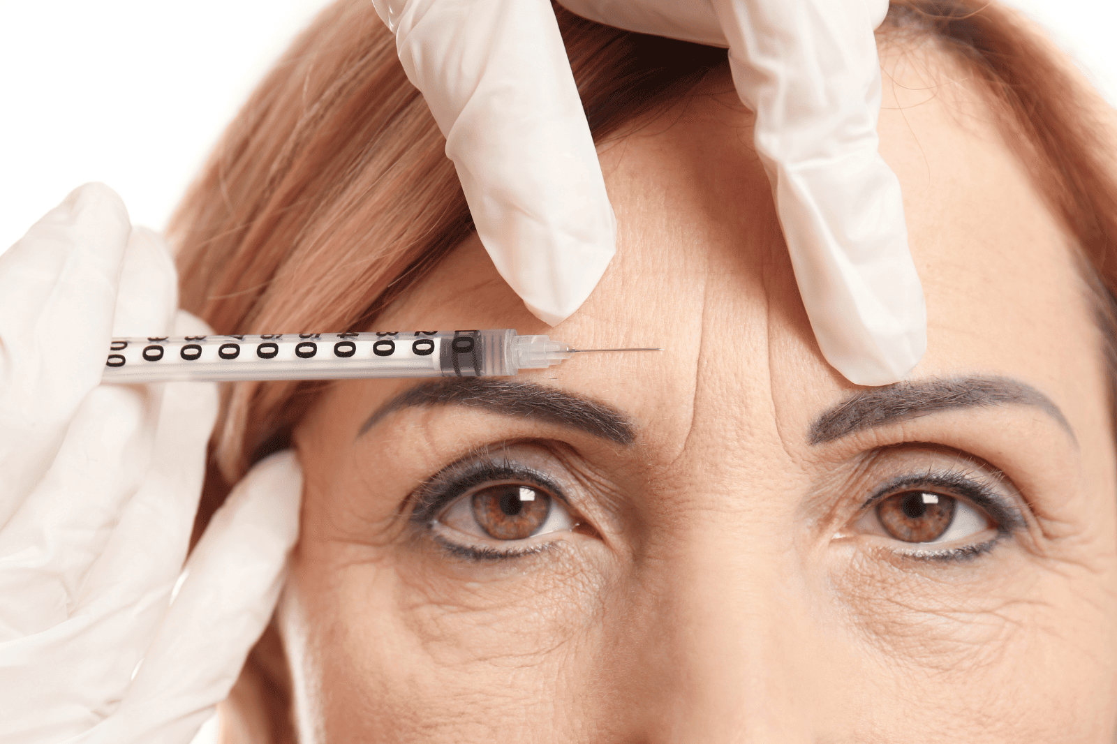Migräne-Behandlung mit Botox: wann es medizinisch sinnvoll ist