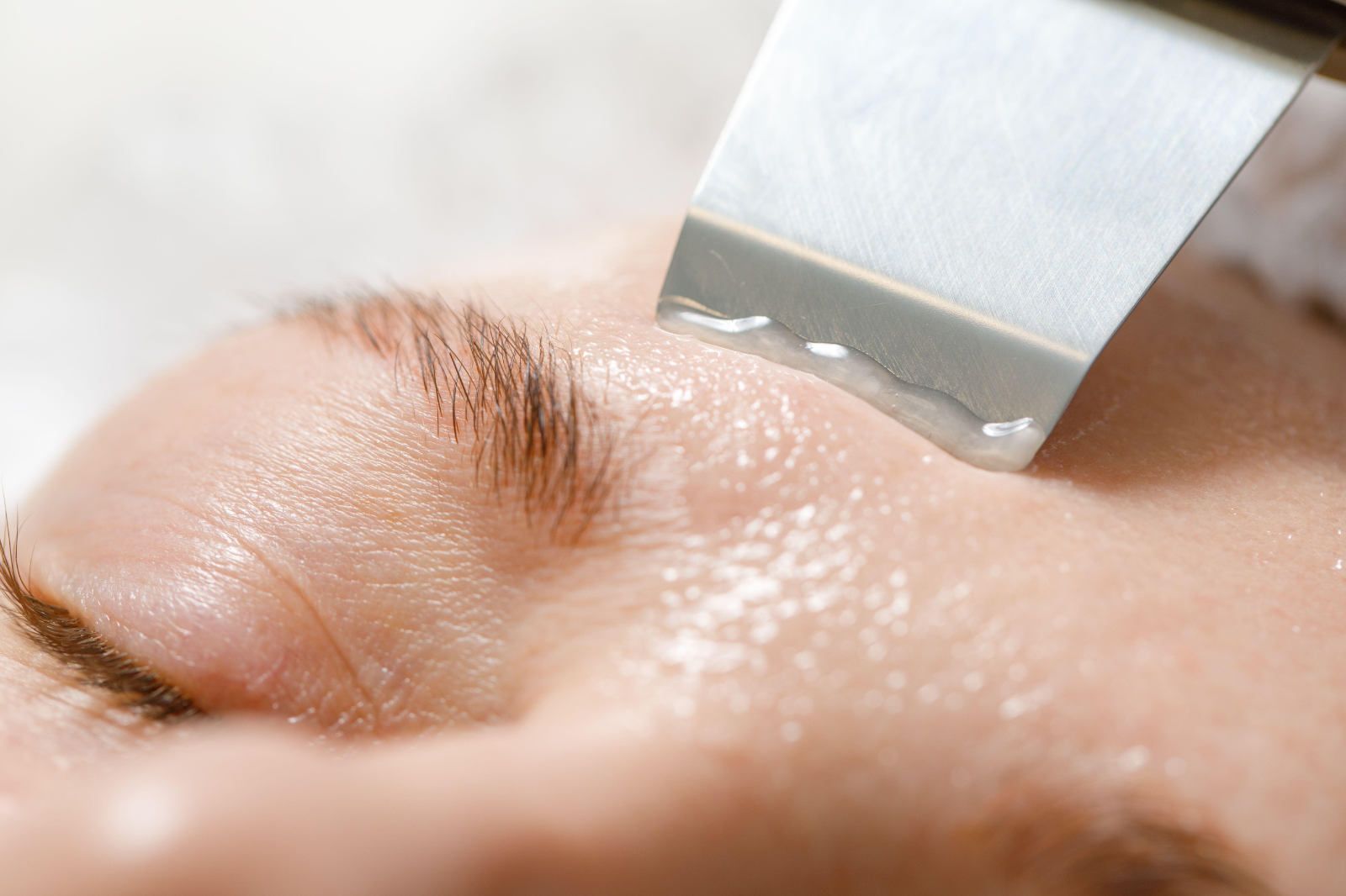 Exosomen & Polynukleotide: regenerative Hautmedizin in Düsseldorf