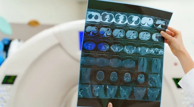 A medical professional holds up a CT scan film in front of a large CT scanner machine in a hospital setting.