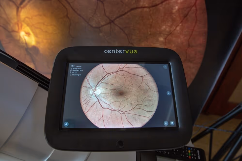 Transforming Vision with Optometrist Care. Digital Retinal Imaging