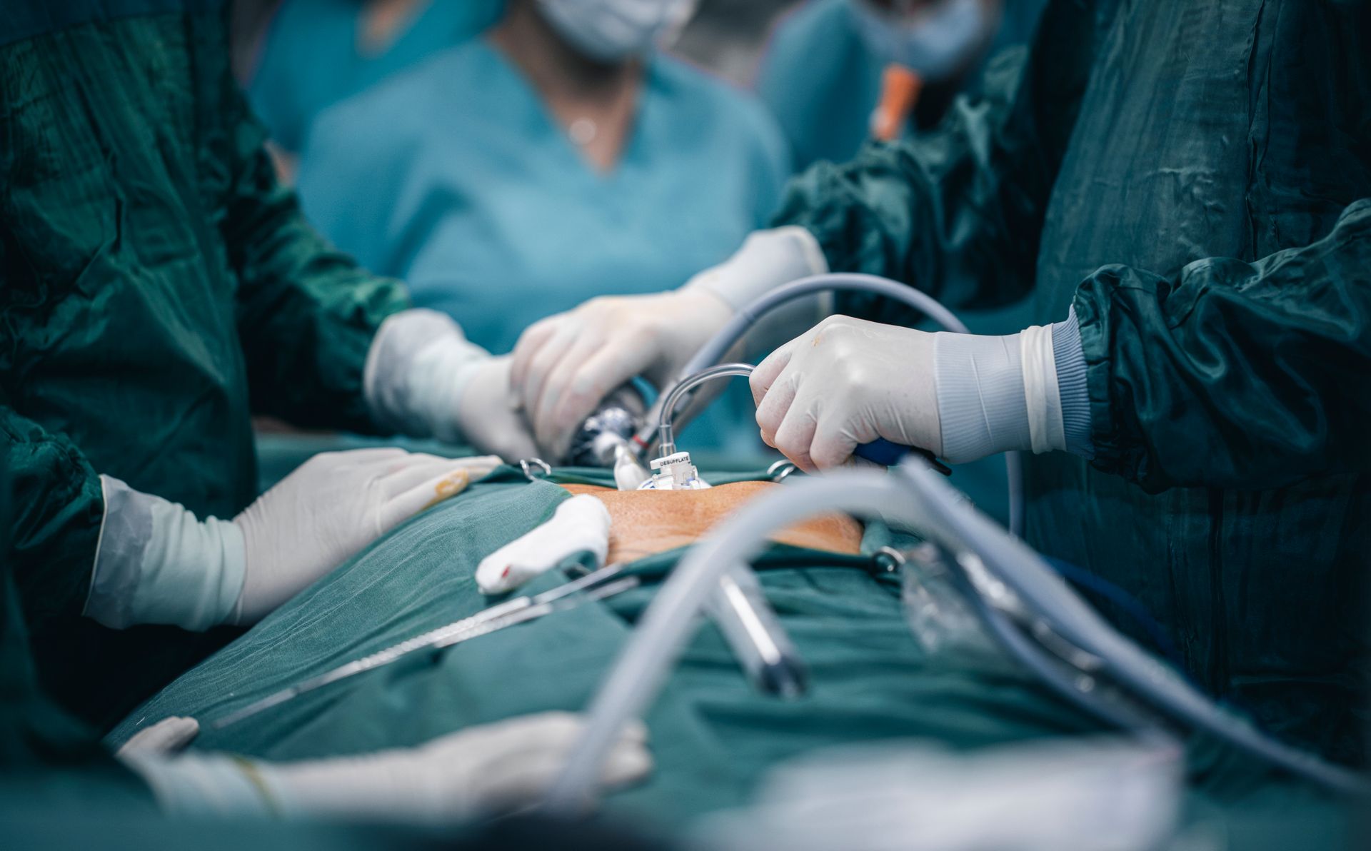 Gloved surgical team working with instruments over a draped patient in an operating theatre.