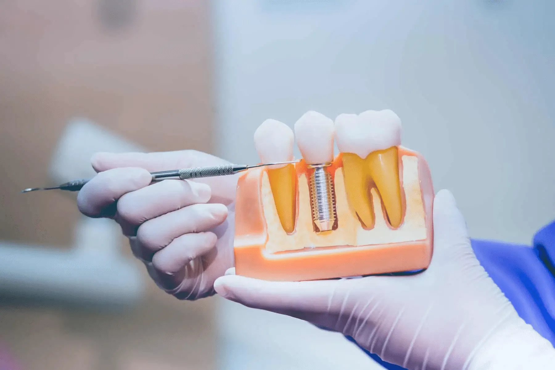 Gloved hands holding and pointing with a dental tool at a model showing natural teeth and a dental implant.