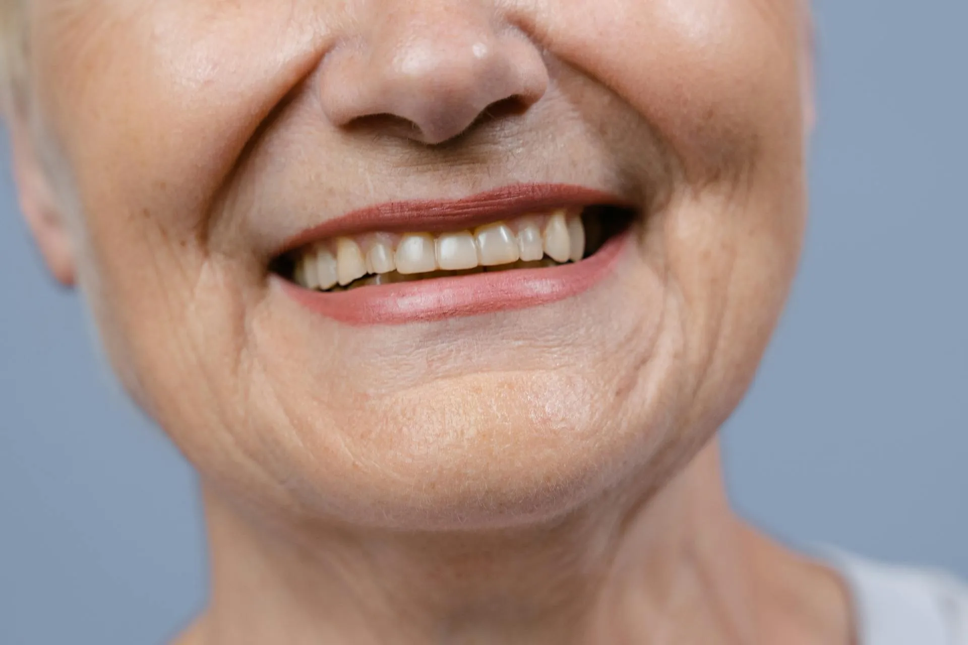 Close-up of an elderly person's smiling mouth showing teeth and lips with wrinkles around.