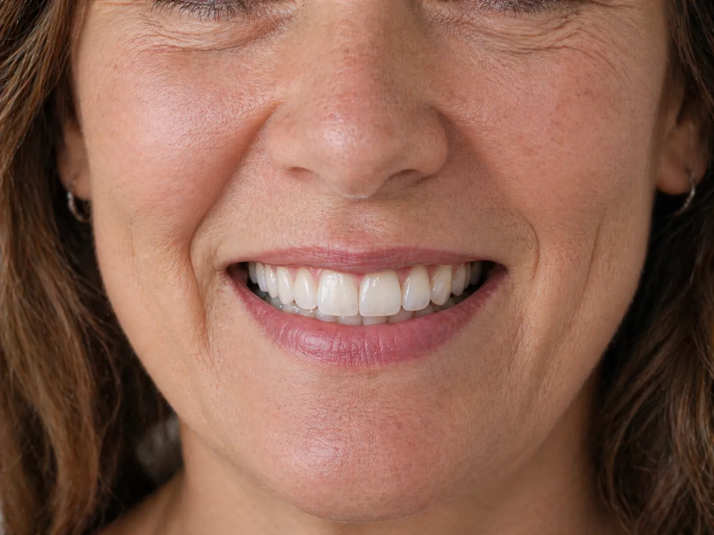 Close-up of a smiling middle-aged woman showing teeth and dimples.