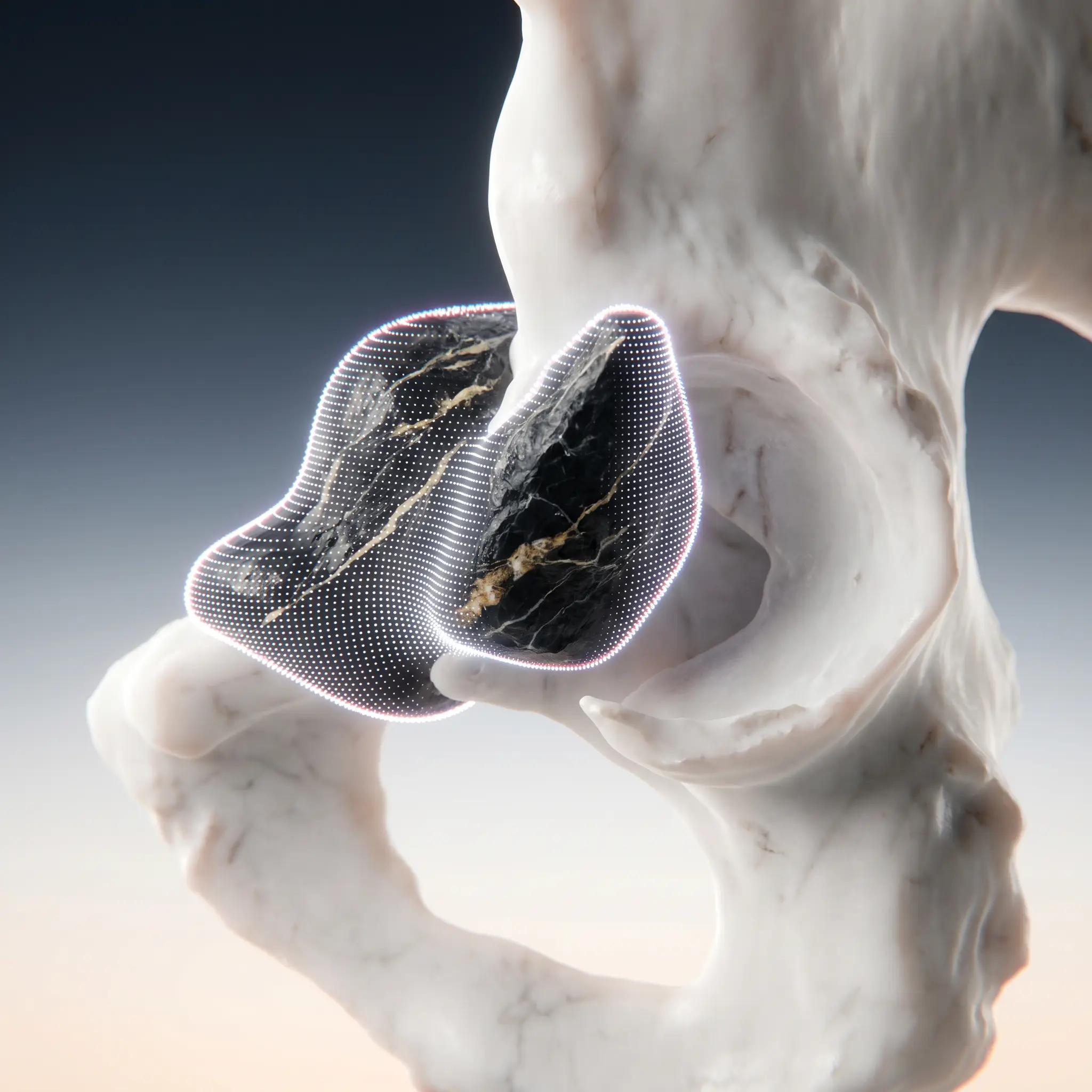 Anatomical Models - Orthopedic Oncology