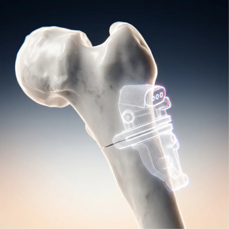 Varus Derotation Osteotomy