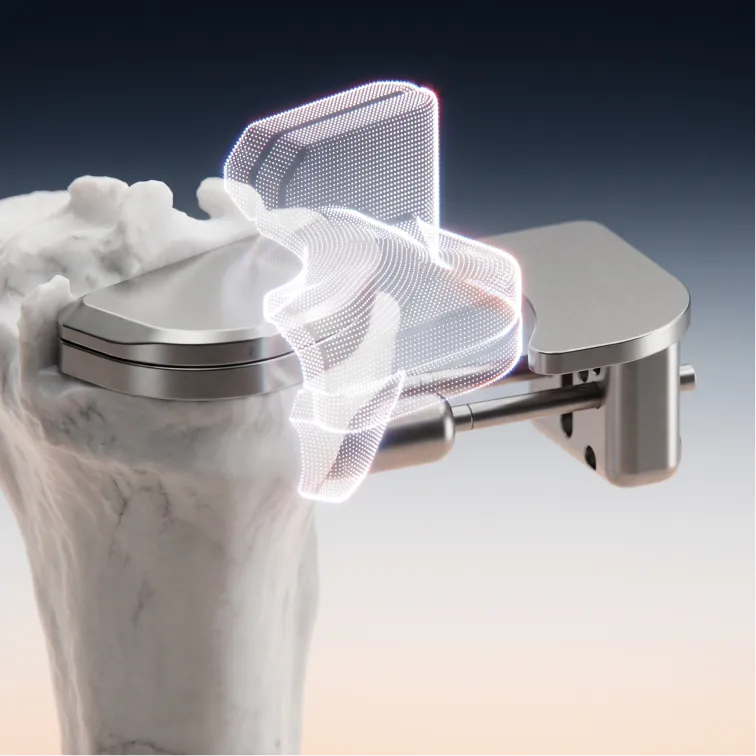 Unicondylar Knee Replacement