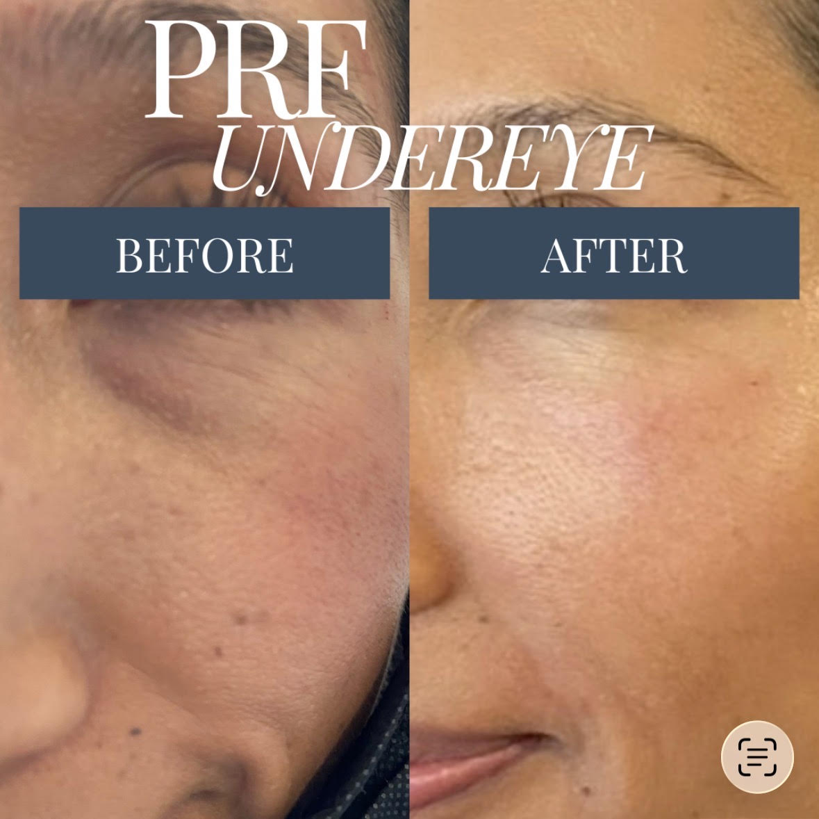 Treatment Results