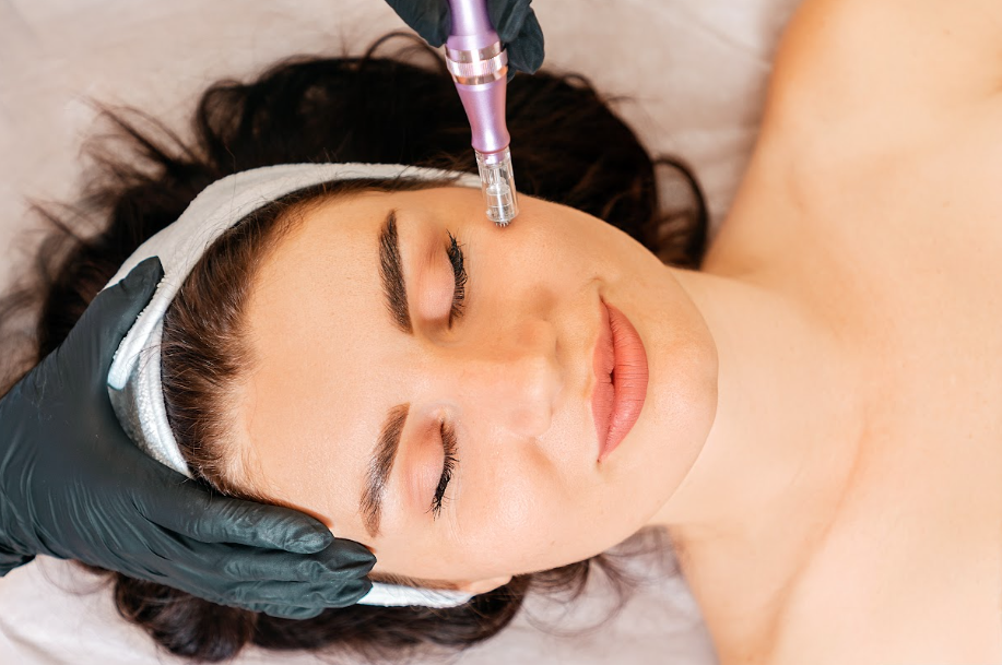 Microneedling