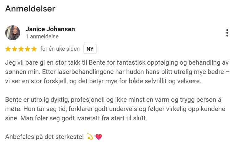 Customer review from Janice Johansen praising Bente for excellent follow-up and treatment, highlighting improved skin condition and professional, warm service.