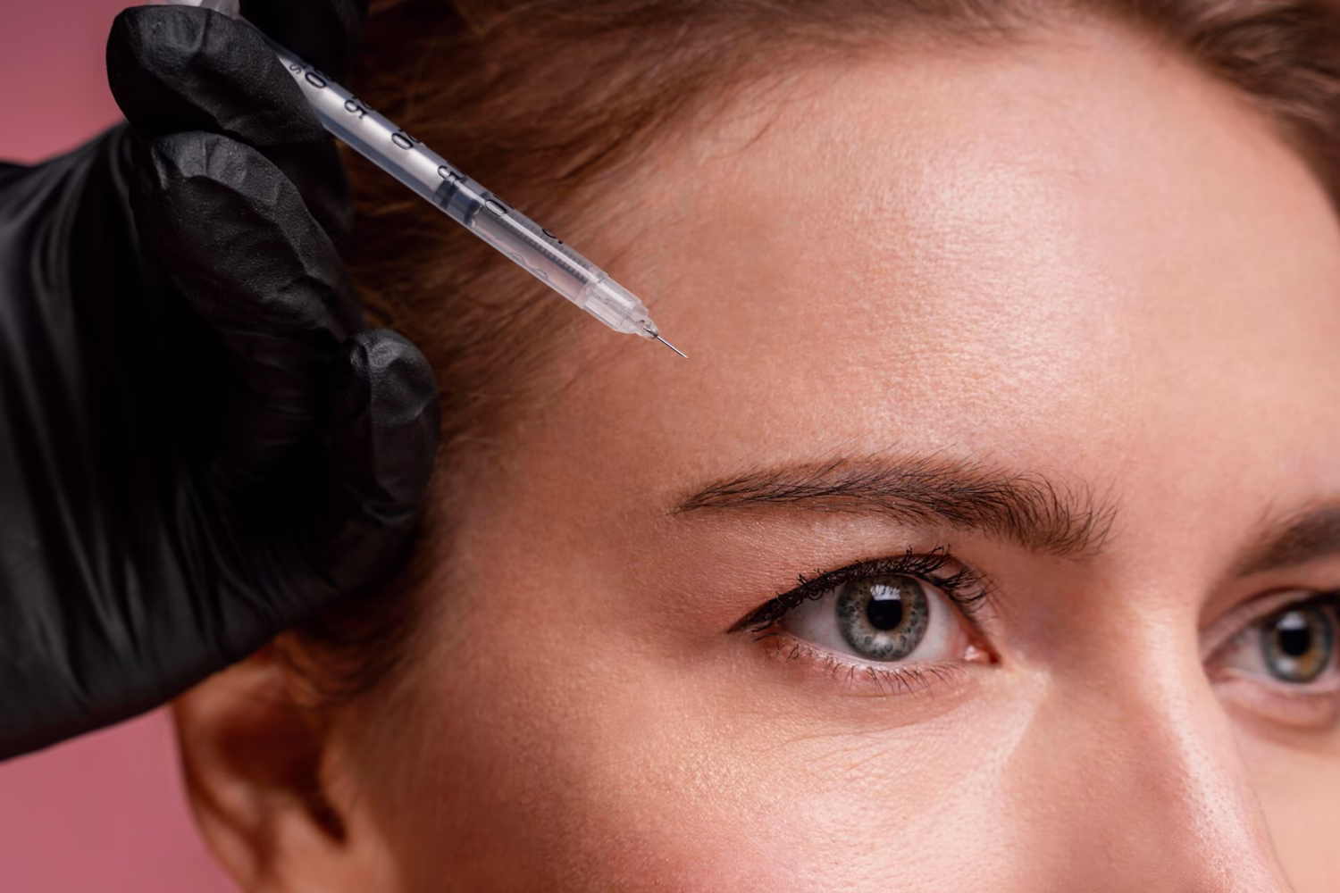 Provider injecting Botox into a woman's forehead lines