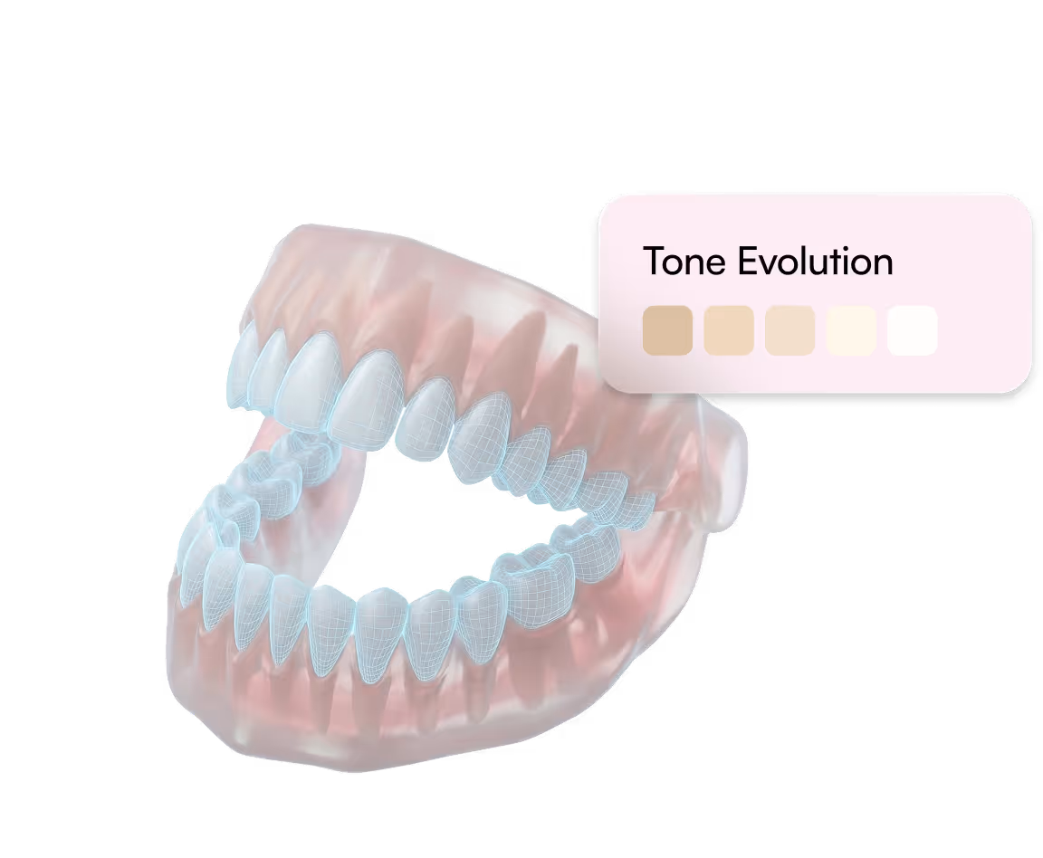 3D translucent model of upper and lower teeth with a color scale labeled Tone Evolution.